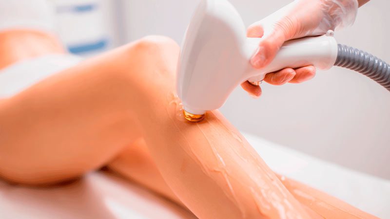 how to find a reputable laser hair removal specialist