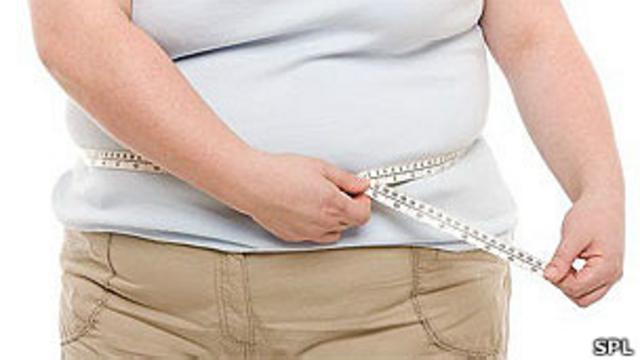 What is a Comprehensive Weight Management Program?