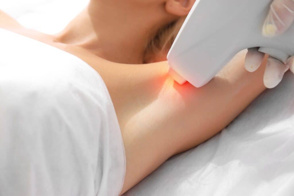 Does Laser Hair Removal Cause Permanent Redness