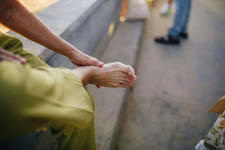 What vitamin deficiency causes heel spurs?